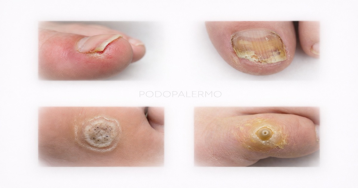 Distintos motivos de consulta podológica atendidos en PODOPALERMO